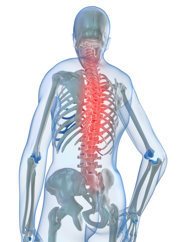 skelett_backpain